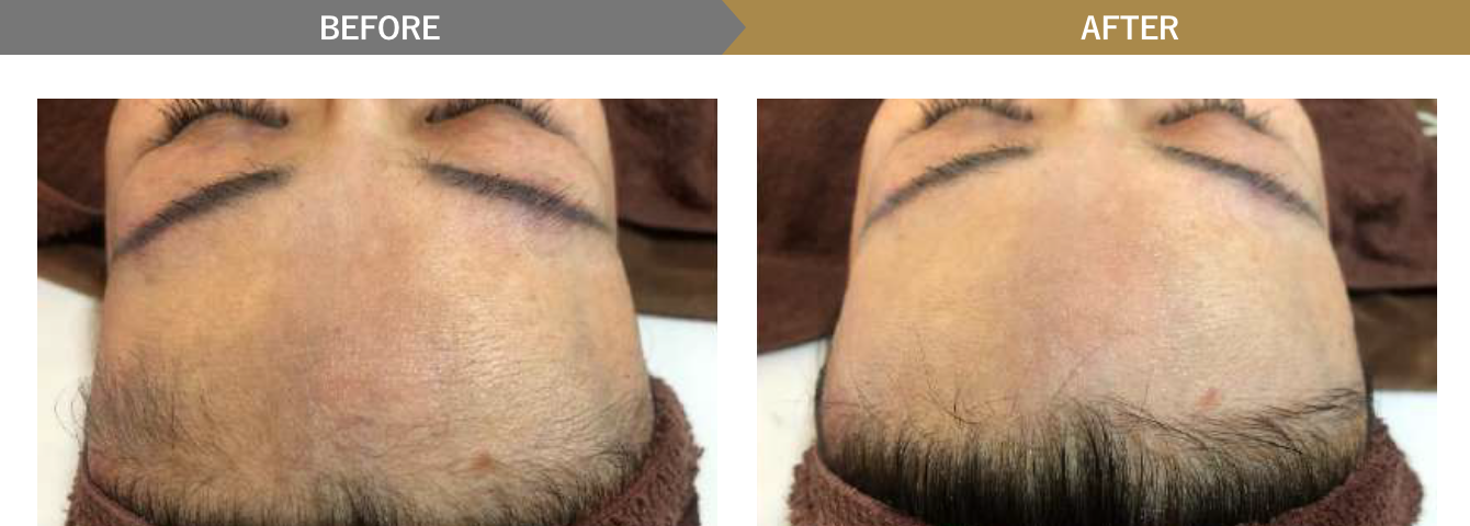 ビフォーアフター写真