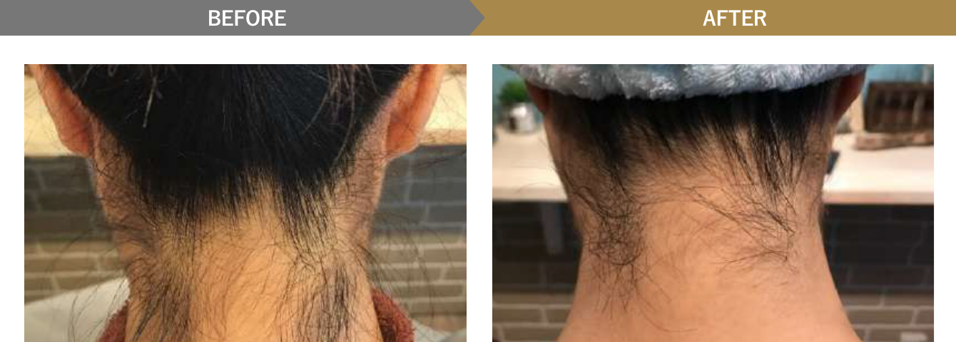 ビフォーアフター写真